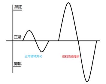 双相情感障碍_双相情感障碍躁狂发作症状_双相情感障碍抑郁发作症状